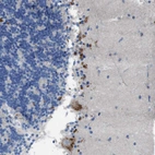 Immunohistochemical staining of human cerebellum shows strong granular cytoplasmic positivity in Purkinje cells.