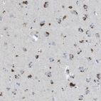 Immunohistochemical staining of human cerebral cortex shows strong granular cytoplasmic positivity in neurons.