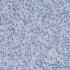 Immunohistochemical staining of human pancreas shows no positivity in exocrine glandular cells as expected.