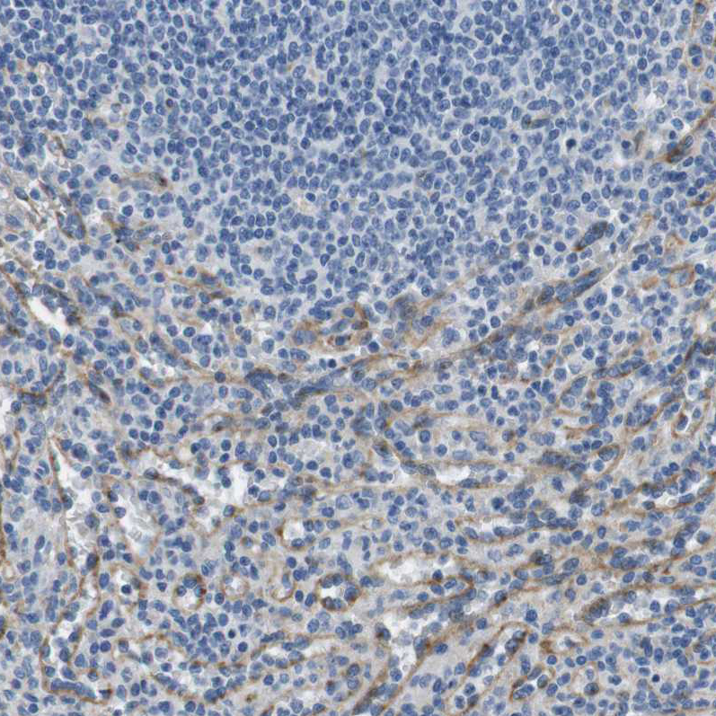Anti-FCGRT Antibody
