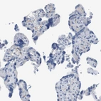 Immunohistochemical staining of human placenta shows weak membranous positivity in Hofbauer cells.
