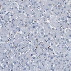 Immunohistochemical staining of human liver shows weak membranous positivity in Kupffer cells.