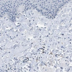Immunohistochemical staining of human skin shows weak membranous positivity in fibroblasts.