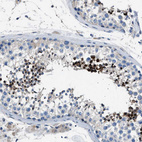 Anti-LRRC37B Antibody
