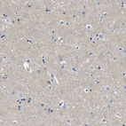 Immunohistochemical staining of human cerebral cortex shows no positivity in neurons as expected.
