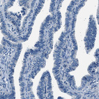 Anti-LRRC37B Antibody