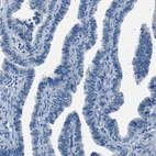 Immunohistochemical staining of human fallopian tube shows no positivity in glandular cells as expected.