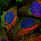 Immunofluorescent staining of human cell line U-2 OS shows localization to cytosol.