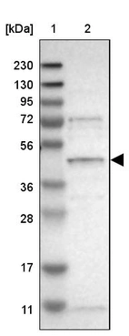 Lane 1: Marker [kDa] 230, 130, 95, 72, 56, 36, 28, 17, 11_br/_Lane 2: Human cell line RT-4