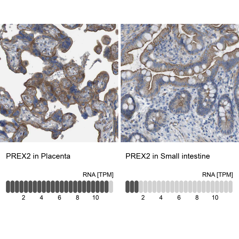 Anti-PREX2 Antibody