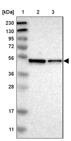 Lane 1: Marker [kDa] 230, 130, 95, 72, 56, 36, 28, 17, 11_br/_Lane 2: Human cell line RT-4_br/_Lane 3: Human cell line U-251MG sp