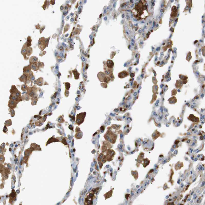 Anti-ADCY10 Antibody
