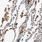 Anti-ADCY10 Antibody