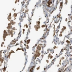 Anti-ADCY10 Antibody