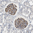 Immunohistochemical staining of human kidney shows strong cytoplasmic positivity in cells in glomeruli.