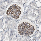 Immunohistochemical staining of human kidney shows strong cytoplasmic positivity in cells in glomeruli.