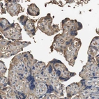 Immunohistochemical staining of human placenta shows moderate cytoplasmic positivity in trophoblastic cells.