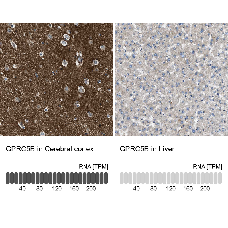 Anti-GPRC5B Antibody