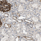 Immunohistochemical staining of human kidney shows strong membranous positivity in cells in glomeruli and distal tubules.