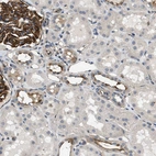 Immunohistochemical staining of human kidney shows strong membranous positivity in cells in glomeruli and distal tubules.