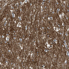 Immunohistochemical staining of human caudate putamen shows strong membranous positivity in glial cells.