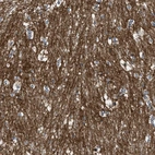 Immunohistochemical staining of human caudate putamen shows strong membranous positivity in glial cells.