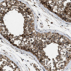 Immunohistochemical staining of human testis shows strong membranous and cytoplasmic positivity in cells in seminiferous ducts.