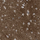 Immunohistochemical staining of human cerebral cortex shows strong membranous positivity in neuropil.