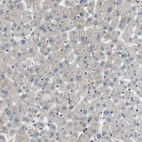 Immunohistochemical staining of human liver shows weak positivity in hepatocytes as expected.