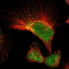 Immunofluorescent staining of human cell line U-251 MG shows localization to nucleus & vesicles.