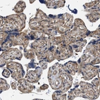 Immunohistochemical staining of human placenta shows moderate cytoplasmic positivity in trophoblastic cells.