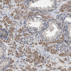 Immunohistochemical staining of human prostate shows moderate cytoplasmic positivity in smooth muscle cells.