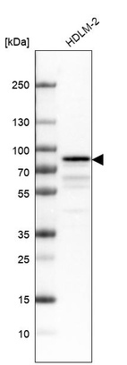Western blot analysis in human cell line HDLM-2.
