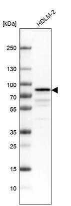 Western blot analysis in human cell line HDLM-2.