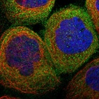 Immunofluorescent staining of human cell line A-431 shows localization to cytosol.