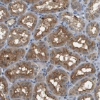 Immunohistochemical staining of human Kidney shows moderate cytoplasmic positivity in cells in tubules.