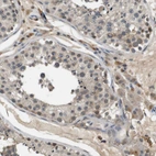Immunohistochemical staining of human Testis shows moderate cytoplasmic positivity in cells in seminiferous ducts and leydig cells.