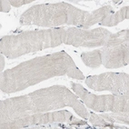 Immunohistochemical staining of human Skeletal muscle shows very weak cytoplasmic positivity in myocytes.