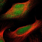Immunofluorescent staining of human cell line U-2 OS shows localization to nucleus & cytosol.