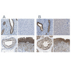 Anti-TES Antibody