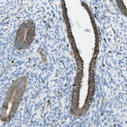 Immunohistochemical staining of human endometrium shows moderate cytoplasmic positivity in glandular cells.