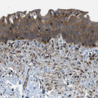 Immunohistochemical staining of human urinary bladder shows strong cytoplasmic positivity in urothelial cells.