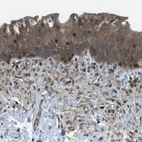 Immunohistochemical staining of human urinary bladder shows strong cytoplasmic positivity in urothelial cells.