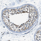 Immunohistochemical staining of human testis shows moderate cytoplasmic positivity in cells in seminiferous ducts.