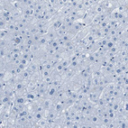 Immunohistochemical staining of human liver shows no positivity in hepatocytes as expected.