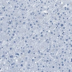 Immunohistochemical staining of human liver shows no positivity in hepatocytes as expected.