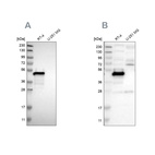 Western blot analysis using Anti-TES antibody HPA015269 (A) shows similar pattern to independent antibody HPA018123 (B).