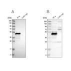Western blot analysis using Anti-TES antibody HPA015269 (A) shows similar pattern to independent antibody HPA018123 (B).