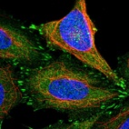 Immunofluorescent staining of human cell line SiHa shows localization to cytosol & focal adhesion sites.