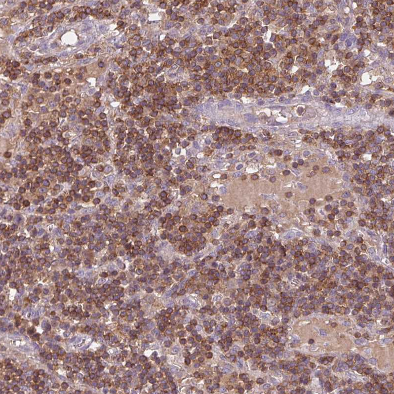 Anti-STK4 Antibody